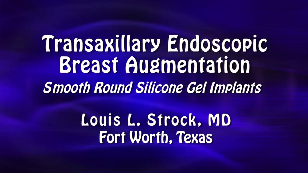 Dr. Strock: Transaxillary Endoscopic Breast Augmentation - Baker Gordon 2024