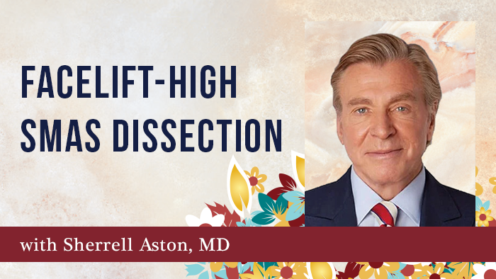 Facelift-High SMAS Dissection